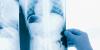 X ray