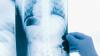 X ray